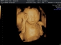 3d-scan_42