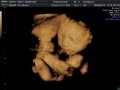 3d-scan_57